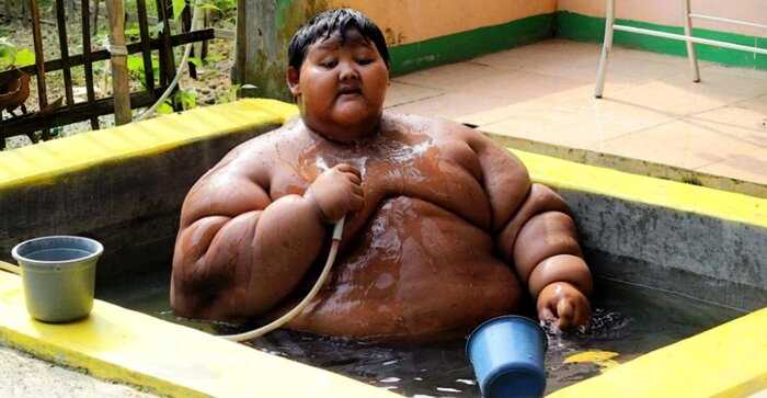 Как после похудения выглядит самый толстый мальчик Индонезии