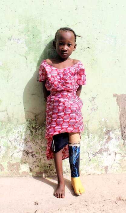 Подросток из Англии отдает свои протезы девочке из Гамбии: история и фото особенных детей