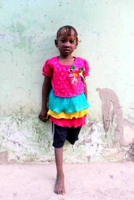 Подросток из Англии отдает свои протезы девочке из Гамбии: история и фото особенных детей
