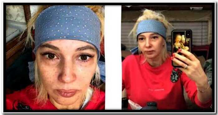«Стала бабкой после родов»: Кудрявцева ужаснула подписчиков снимком без макияжа