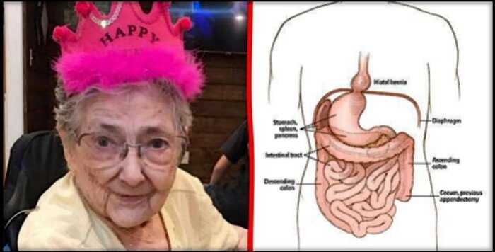 Американка с зеркально расположенными органами прожила 99 лет