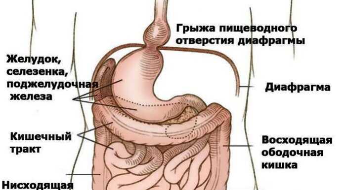 Американка с зеркально расположенными органами прожила 99 лет