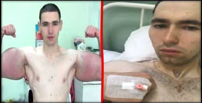 «Базуки ушли на покой»: Кирилл Терешин наконец перенес операцию