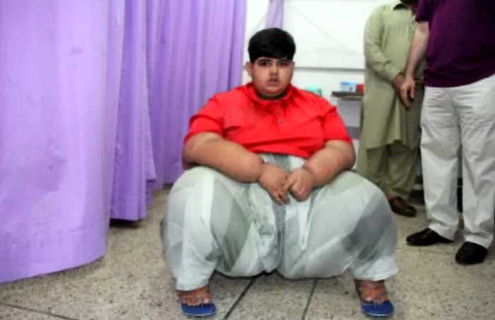 История мальчика-тяжеловеса из Пакистана, который весил 197кг в 10 лет
