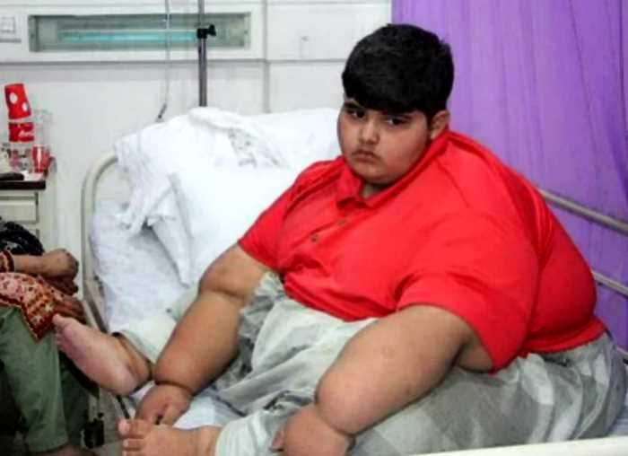 История мальчика-тяжеловеса из Пакистана, который весил 197кг в 10 лет