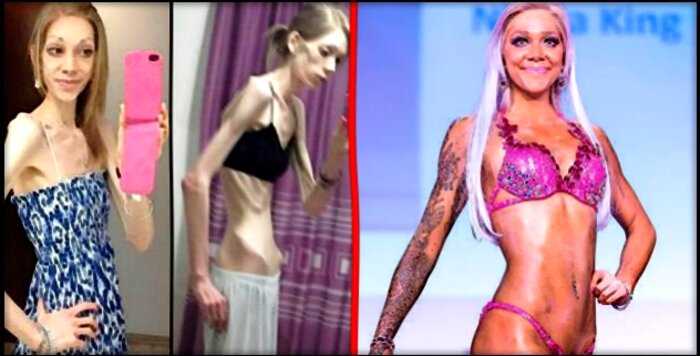 Страдающая от анорексии британка увлеклась бодибилдингом и стала красоткой