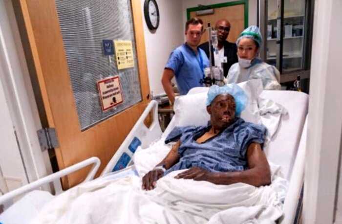 Первая в мире пересадка лица темнокожему пациенту прошла успешно