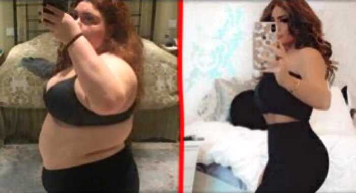22-летняя актриса ушила желудок, похудела на 50 кг и стала красоткой