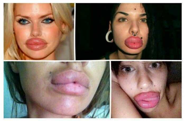 12+ сравнений, на что похожи женщины, которые безбожно увеличивают губы