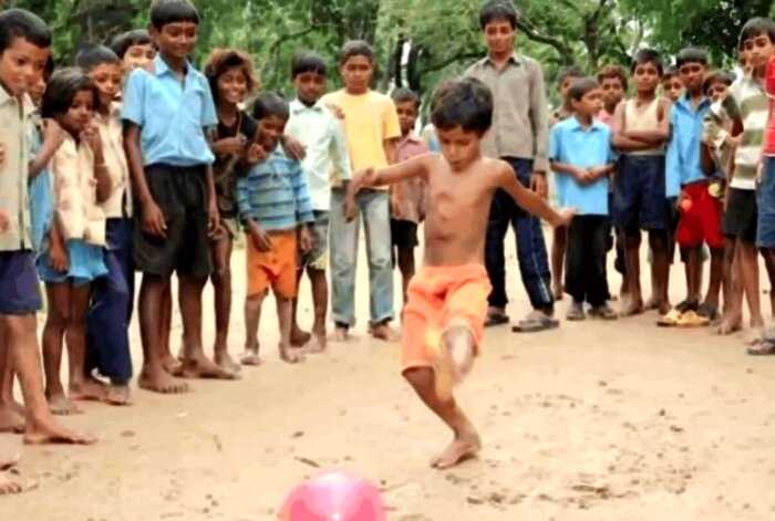 История удивительного мальчика из Индии, который родился с 8 руками и ногами