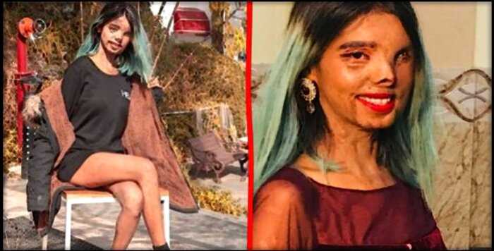 Индийская девушка, которую хотел убить отец, выжила и призывает людей не терять веру