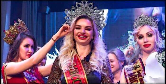 «Пластическая победа»: 4 российские королевы красоты, которые вызвали пересуды