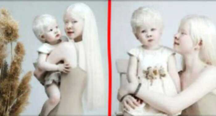 Сестры-альбиносы из Казахстана стремительно покоряют соц-сети
