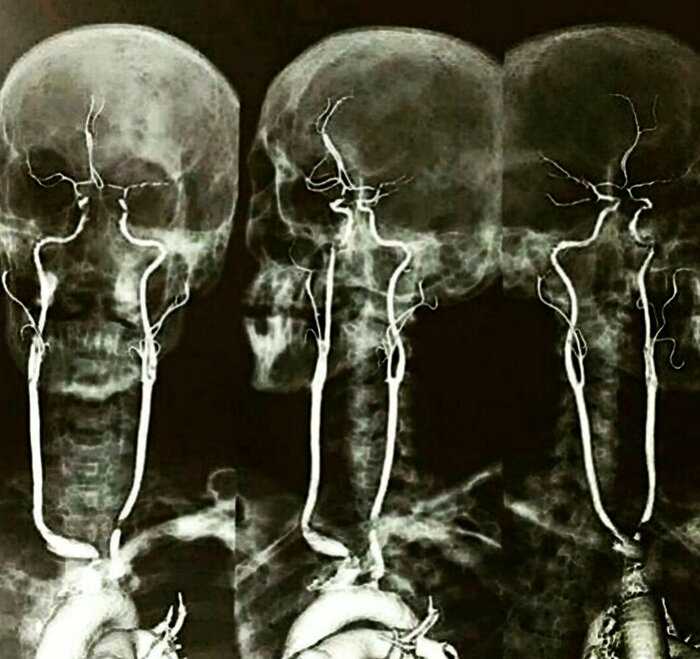 18 шокирующих рентгеновских снимков, которые врачи не забудут никогда