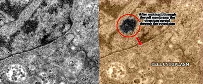 Учёные показали момент заражения коронавирусом под микроскопом