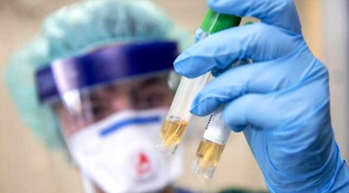 «Обнадеживающий сигнал»: ученые нашли слабое место у коронавируса