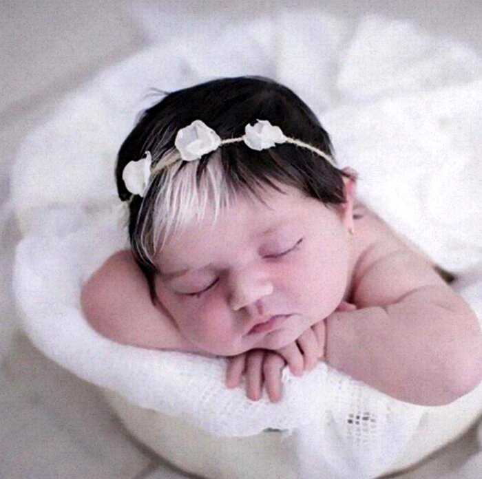 Девочка родилась с белой прядью в волосах и её мама делает всё, чтобы она ценила свою уникальность