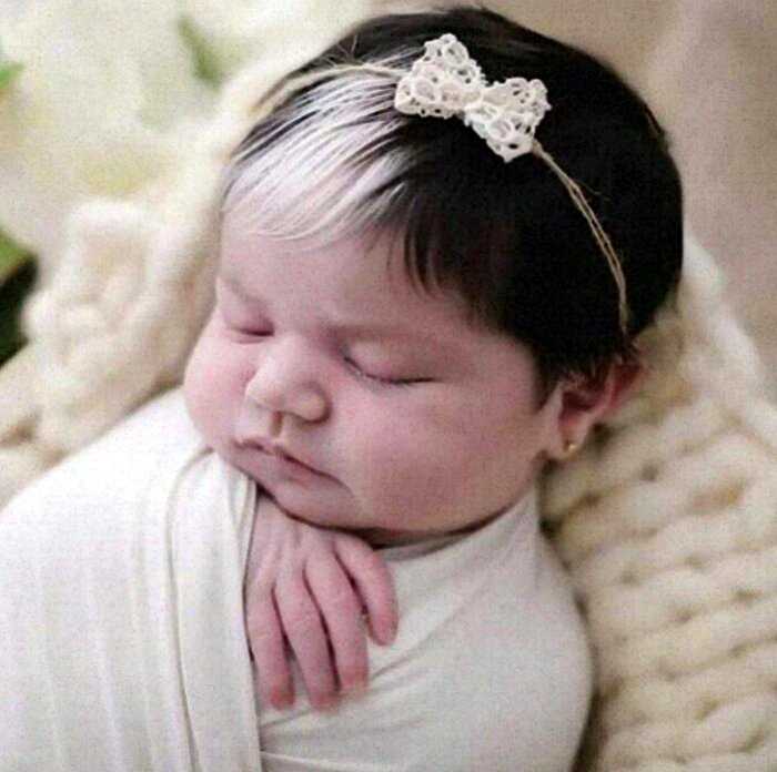 Девочка родилась с белой прядью в волосах и её мама делает всё, чтобы она ценила свою уникальность