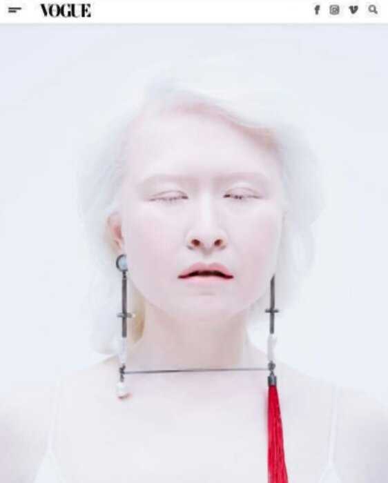 Редкая красота: 10 людей-альбиносов, от лиц которых сложно оторвать взгляд