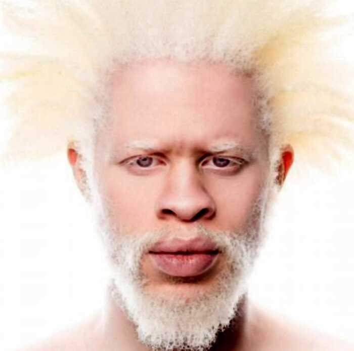 Редкая красота: 10 людей-альбиносов, от лиц которых сложно оторвать взгляд