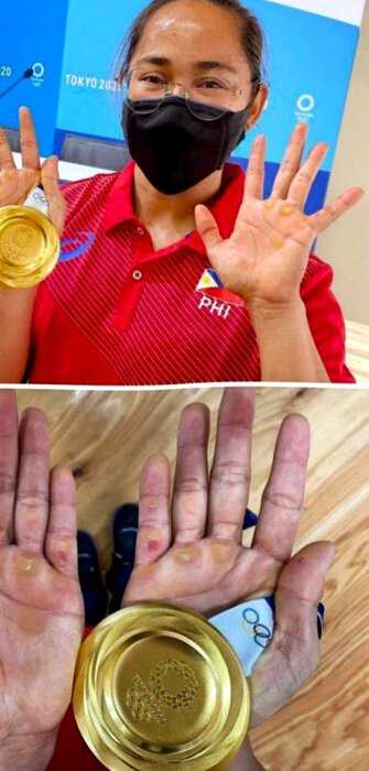10 фото из жизни олимпийцев, которые покажут нам обратную сторону олимпийского золота