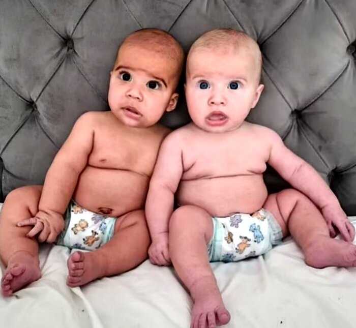 Девушка родила близнецов, но никто не может в это поверить, ведь они своем не похожи друг на друга