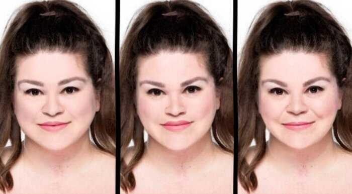Женщина попросила трех врачей сделать ей модельное лицо: вот что из этого вышло