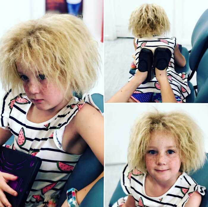 «Синдром непослушных волос»: девочка из Австралии покорила Instagram