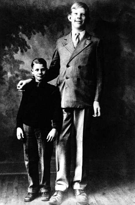 Рост 3 метра считали выдумкой, но на архивных фото и видео запечатлен великан выше. Мужчину звали Роберт Уодлоу