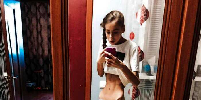 Дохуделись: несколько лет назад сестры Леденевы довели свой вес до 36 кг… Как девочки живут сейчас