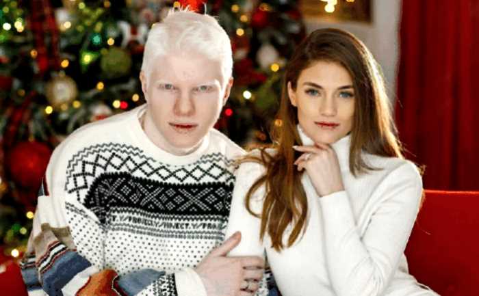 Как выглядит ребенок этой необычной пары: альбинос Бера Иванишвили и его жена Нанука Гудавадзе