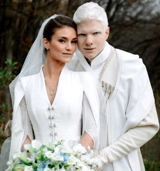 Как выглядит ребенок этой необычной пары: альбинос Бера Иванишвили и его жена Нанука Гудавадзе