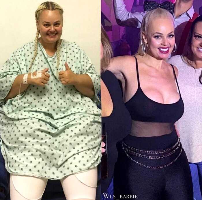 Женщина сбросила 100 кг и превратилась в настоящую Барби, как и мечтала с детства